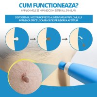 Dispozitiv Indepartare Papiloame prin Ligaturare, LittleDomi, Skin Tag Removal Kit, pentru Fata, Gat, Corp, Dimensiuni - 7