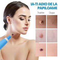 Dispozitiv Indepartare Papiloame prin Ligaturare, LittleDomi, Skin Tag Removal Kit, pentru Fata, Gat, Corp, Dimensiuni - 3