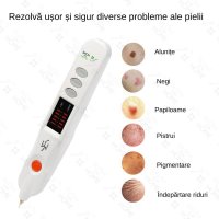 Aparat Fibroblast Plasma Pen, GlowforHome, pentru indepartarea Tatuajelor, Cicatricilor, Alunitelor, Pistruilor, Alb - 3