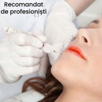 Aparat Fibroblast Plasma Pen, GlowforHome, pentru indepartarea Tatuajelor, Cicatricilor, Alunitelor, Pistruilor, Alb - 1