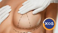 Estet Laser Bucuresti – interventii estetice cu rezultate reale - 4