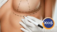 Estet Laser Bucuresti – interventii estetice cu rezultate reale - 5