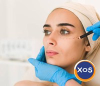 Estet Laser Bucuresti – interventii estetice cu rezultate reale - 6