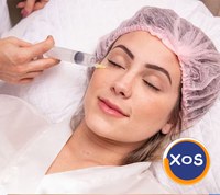 Toxina botulinica - interventii de succes la Clinica Estet Laser - 2