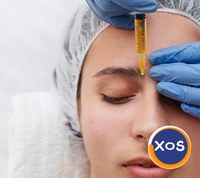 Toxina botulinica - interventii de succes la Clinica Estet Laser - 4