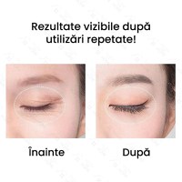 Aparat cu ultrasunete, GlowforHome, pentru remodelare corporala, reducerea grasimii, EMS, microcurent, wireless, mov - 1