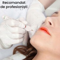 Aparat Fibroblast Plasma Pen, GlowforHome, pentru indepartarea Tatuajelor, Cicatricilor, Alunitelor, Pistruilor, Alb - 1