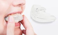 Aparat ortodontic mobil tip gutiera din silicon Hard Phase 3, pentru copii si adulti, MyStyle® trainer - 2