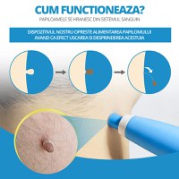 Dispozitiv Indepartare Papiloame prin Ligaturare, LittleDomi, Skin Tag Removal Kit, pentru Fata, Gat, Corp, Dimensiuni - 7