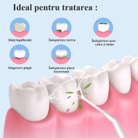 Irigator Oral pentru Dus Bucal MRG MA8, 4 Capete curatare, cu Acumulator - 6