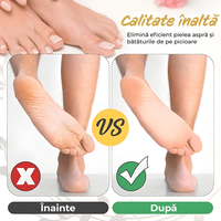 Set accesorii pentru Pila electrica pentru talpi si calcaie IMA Trend, 3 role, Indepartare piele moarta - 2